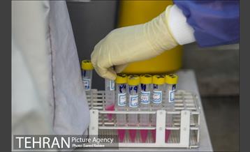انجام تست رایگان PCR توسط شهرداری تهران 22