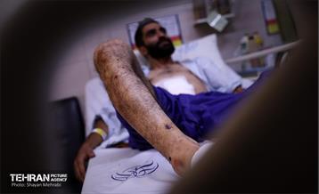 مجروحان جنایت‌های رژیم صهیونیستی. 1