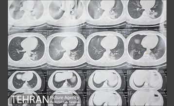 بخش بیماران کرونایی بیمارستان بعثت 26