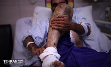 مجروحان جنایت‌های رژیم صهیونیستی. 2